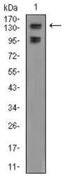 Anti-FBXL10 antibody [6F6G11] used in Western Blot (WB). GTX04628