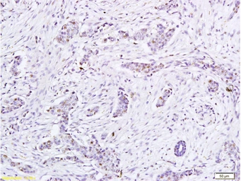Anti-Human Papillomavirus type 16 E6 antibody used in IHC (Paraffin sections) (IHC-P). GTX04630