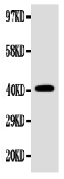 Anti-EDA antibody used in Western Blot (WB). GTX04635