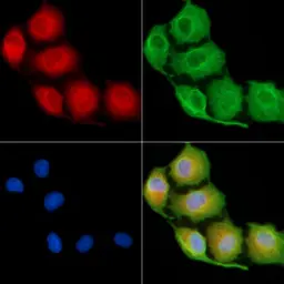 Anti-EDAR antibody used in Immunocytochemistry/ Immunofluorescence (ICC/IF). GTX04637