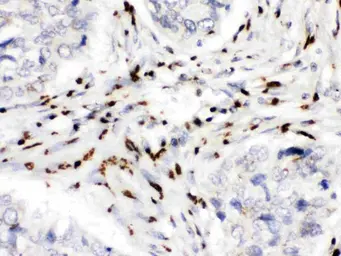 Anti-MDMX antibody used in IHC (Paraffin sections) (IHC-P). GTX04638
