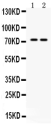 Anti-MDMX antibody used in Western Blot (WB). GTX04638