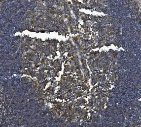 Anti-IL3 Receptor beta antibody used in IHC (Paraffin sections) (IHC-P). GTX04641