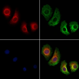 Anti-SCD antibody used in Immunocytochemistry/ Immunofluorescence (ICC/IF). GTX04643