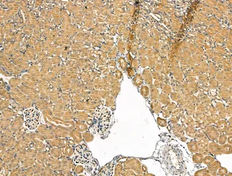 Anti-SCD antibody used in IHC (Paraffin sections) (IHC-P). GTX04643
