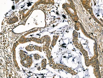 Anti-SCD antibody used in IHC (Paraffin sections) (IHC-P). GTX04643