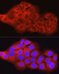 Anti-SCD antibody used in Immunocytochemistry/ Immunofluorescence (ICC/IF). GTX04645
