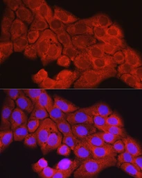 Anti-SCD antibody used in Immunocytochemistry/ Immunofluorescence (ICC/IF). GTX04645
