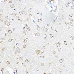 Anti-SCD antibody used in IHC (Paraffin sections) (IHC-P). GTX04645