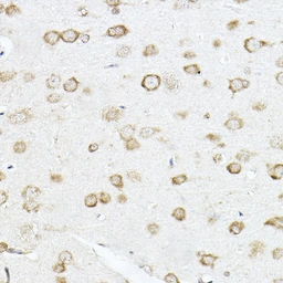 Anti-SCD antibody used in IHC (Paraffin sections) (IHC-P). GTX04645