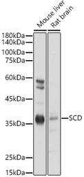 Anti-SCD antibody used in Western Blot (WB). GTX04645