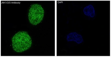 Anti-JNK antibody [DFI-13] used in Immunocytochemistry/ Immunofluorescence (ICC/IF). GTX04659