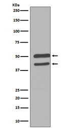 Anti-JNK antibody [DFI-13] used in Western Blot (WB). GTX04659