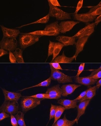 Anti-Apolipoprotein A2 antibody used in Immunocytochemistry/ Immunofluorescence (ICC/IF). GTX04661