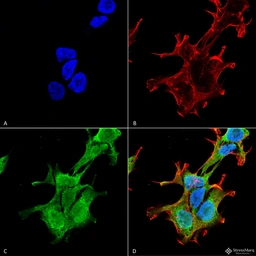 Anti-PINK1 antibody [S4-15] used in Immunocytochemistry/ Immunofluorescence (ICC/IF). GTX04667