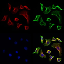 Anti-FAP antibody used in Immunocytochemistry/ Immunofluorescence (ICC/IF). GTX04673