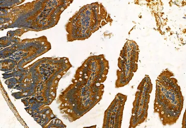 Anti-FAP antibody used in IHC (Paraffin sections) (IHC-P). GTX04673