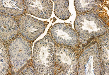 Anti-FAP antibody used in IHC (Paraffin sections) (IHC-P). GTX04673