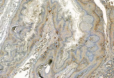 Anti-FAP antibody used in IHC (Paraffin sections) (IHC-P). GTX04673