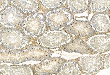 Anti-FAP antibody used in IHC (Paraffin sections) (IHC-P). GTX04673