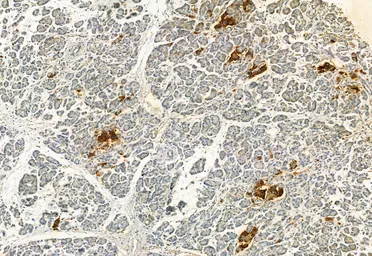 Anti-FAP antibody used in IHC (Paraffin sections) (IHC-P). GTX04673