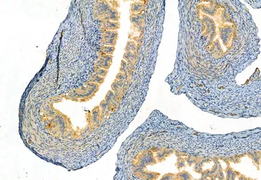 Anti-FAP antibody used in IHC (Paraffin sections) (IHC-P). GTX04673