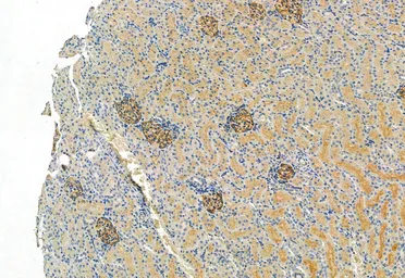 Anti-FAP antibody used in IHC (Paraffin sections) (IHC-P). GTX04673