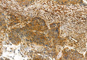 Anti-FAP antibody used in IHC (Paraffin sections) (IHC-P). GTX04673