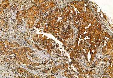 Anti-FAP antibody used in IHC (Paraffin sections) (IHC-P). GTX04673