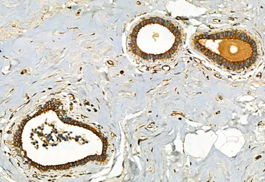 Anti-FAP antibody used in IHC (Paraffin sections) (IHC-P). GTX04673
