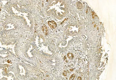 Anti-FAP antibody used in IHC (Paraffin sections) (IHC-P). GTX04673