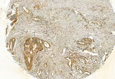 Anti-FAP antibody used in IHC (Paraffin sections) (IHC-P). GTX04673