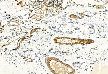 Anti-FAP antibody used in IHC (Paraffin sections) (IHC-P). GTX04673