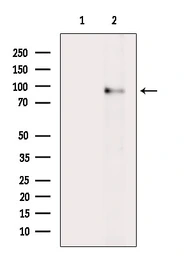 Anti-FAP antibody used in Western Blot (WB). GTX04673