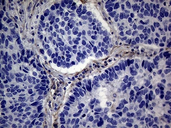 Anti-PMP22 antibody [OTI5D1] used in IHC (Paraffin sections) (IHC-P). GTX04688
