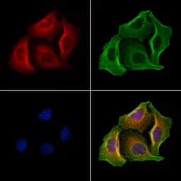 Anti-Gasdermin D antibody used in Immunocytochemistry/ Immunofluorescence (ICC/IF). GTX04690