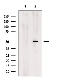 Anti-Gasdermin D antibody used in Western Blot (WB). GTX04690