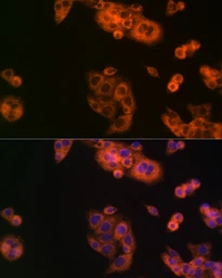 Anti-BCAT1 antibody used in Immunocytochemistry/ Immunofluorescence (ICC/IF). GTX04696
