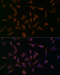 Anti-BCAT1 antibody used in Immunocytochemistry/ Immunofluorescence (ICC/IF). GTX04696