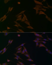 Anti-BCAT1 antibody used in Immunocytochemistry/ Immunofluorescence (ICC/IF). GTX04696