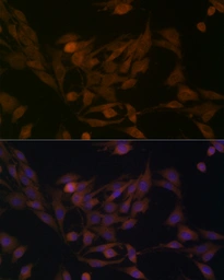 Anti-BCAT1 antibody used in Immunocytochemistry/ Immunofluorescence (ICC/IF). GTX04696
