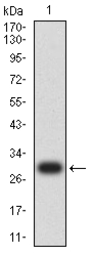 Anti-CD79a antibody [4A10D12] used in Western Blot (WB). GTX04701