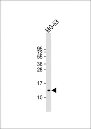 Anti-Osteocalcin antibody used in Western Blot (WB). GTX04704