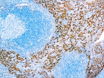 Anti-Cytokeratin 5/14 antibody [XM26 + LL002] used in IHC (Paraffin sections) (IHC-P). GTX04713