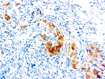 Anti-Inhibin alpha antibody [R1] used in IHC (Paraffin sections) (IHC-P). GTX04714