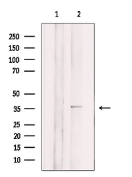Anti-CD300LG antibody used in Western Blot (WB). GTX04718