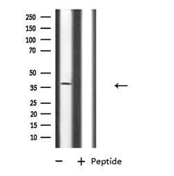 Anti-CD300LG antibody used in Western Blot (WB). GTX04718
