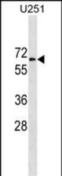 Anti-GGT1 antibody used in Western Blot (WB). GTX04721