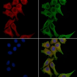 Anti-CD66b antibody used in Immunocytochemistry/ Immunofluorescence (ICC/IF). GTX04722