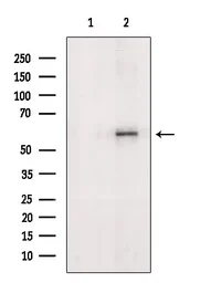 Anti-GGT1 antibody used in Western Blot (WB). GTX04723